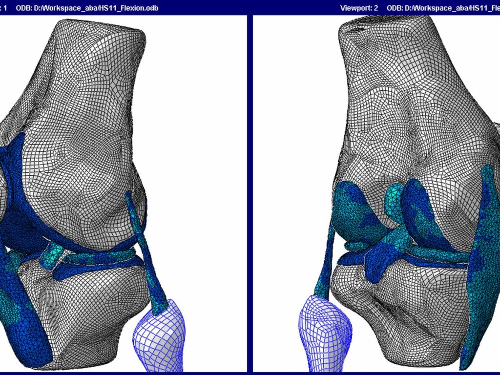 Human knee joint FE model